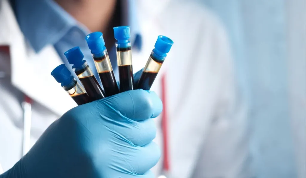 blood sample from lab - Lynk Diagnostics blood sample from lab