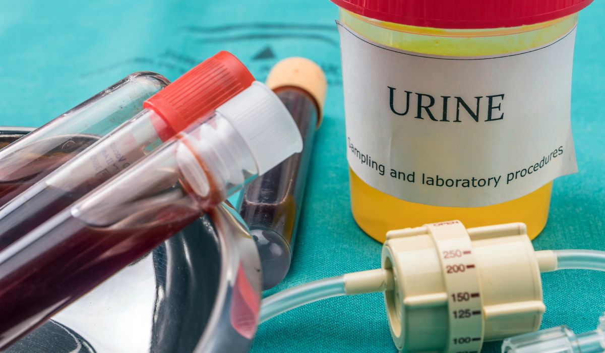 Ethyl Sulfate In Urine testing