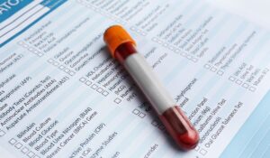 blood testing results