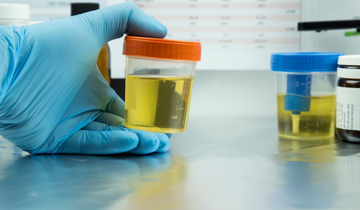 does kratom show up in a urine test