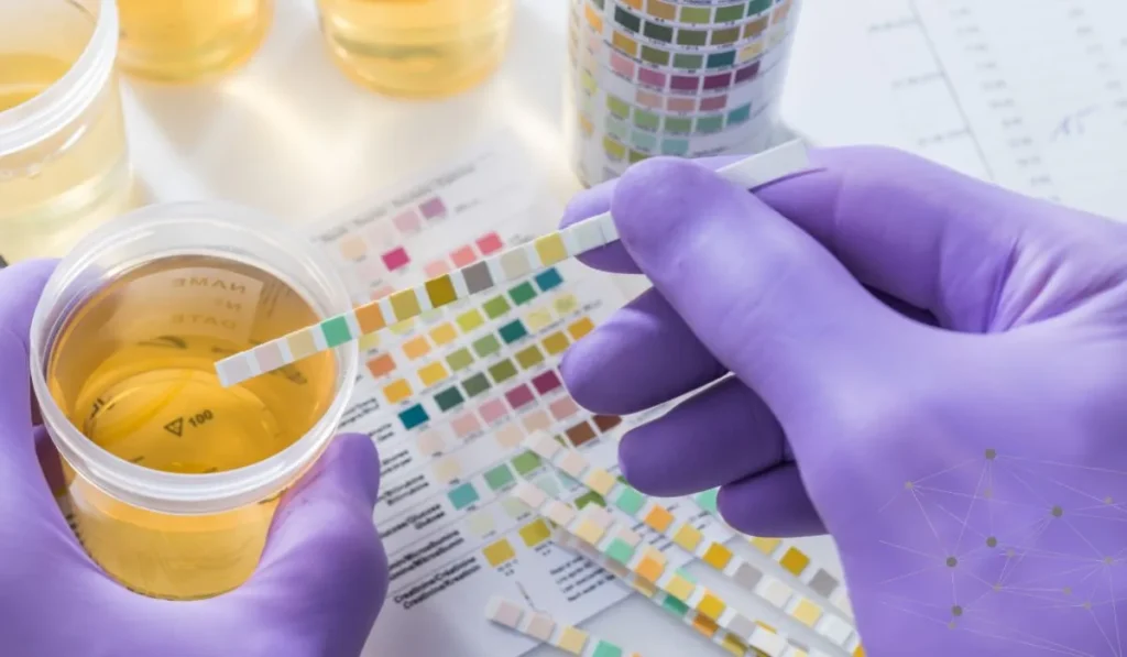 Ethyl Sulfate in Urine - Lynk Diagnostics Ethyl Sulfate in Urine