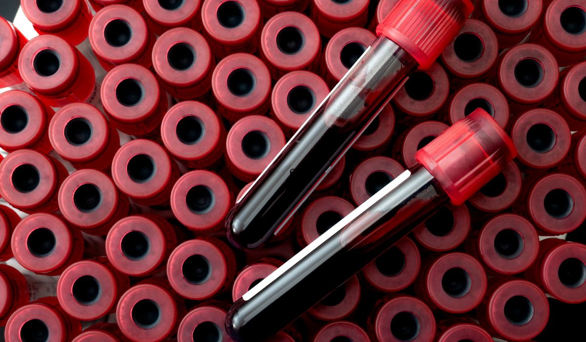 Does Butalbital Show Up on a Drug Test