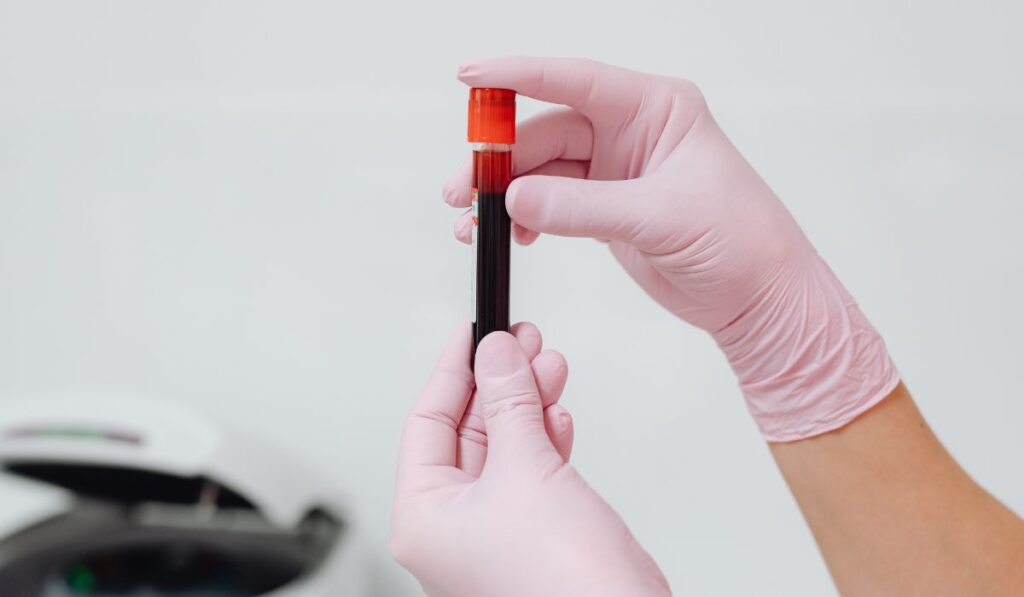 blood results for Lorazepam