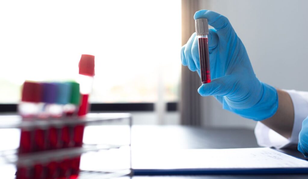 blood testing for duloxetine drug - Lynk Diagnostics blood testing for duloxetine drug