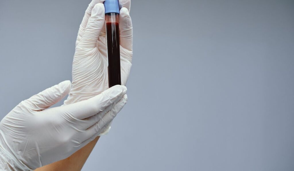 does nortriptyline show up in a drug test