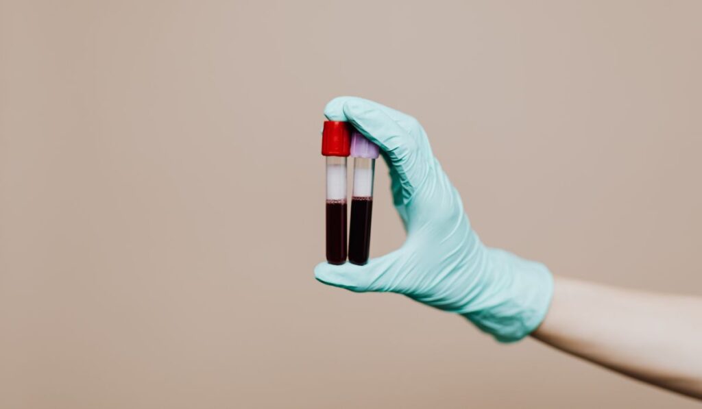 does sertraline show up in a drug test