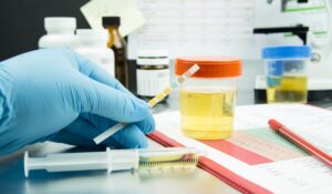 does temazepam show on urine test
