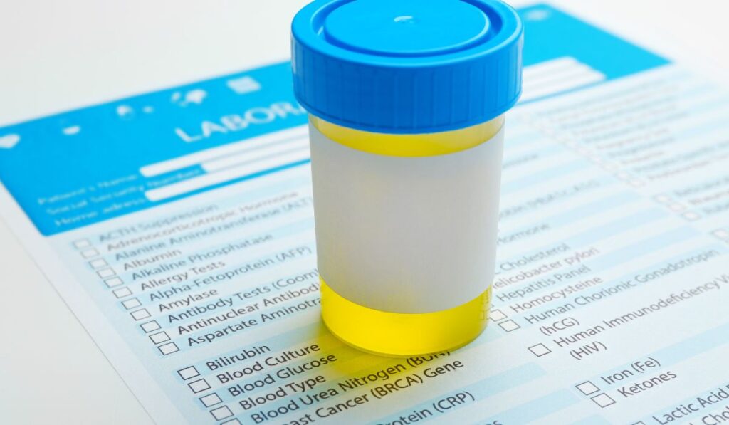 urine sample for Venlafaxine