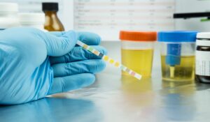 urine testing