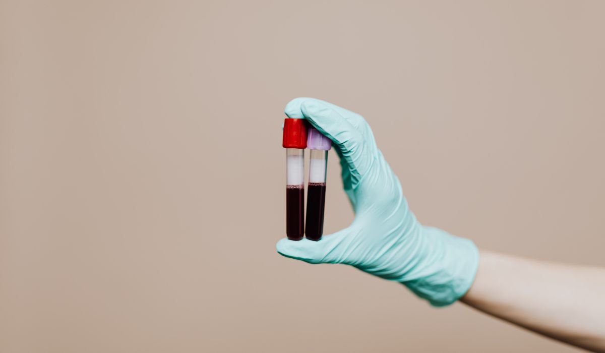 What Is PCP on a Drug Test Understanding Results 1