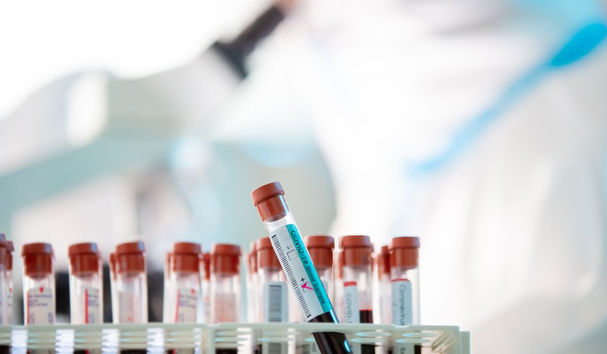 Does 4-hydroxyxylazine show up on a drug test