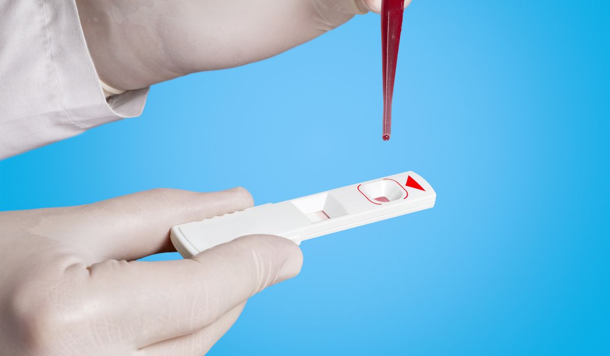 Does Mephedrone Show Up on a Drug Test