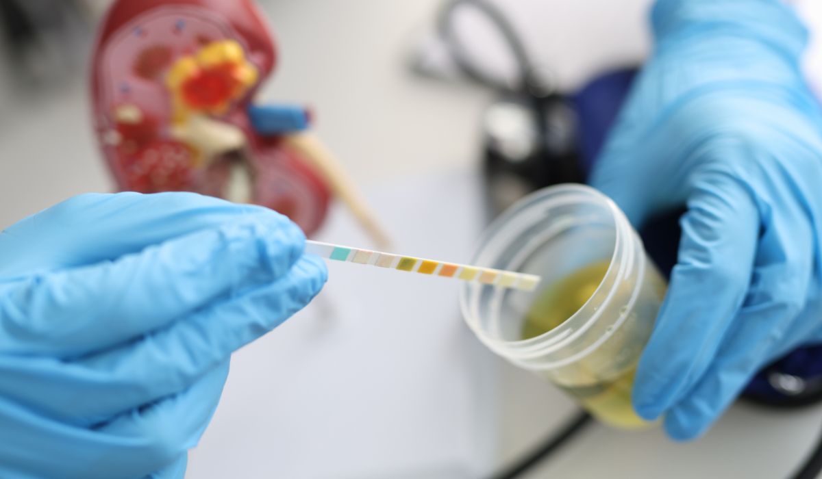 Does Norbuprenorphine show up on a drug test