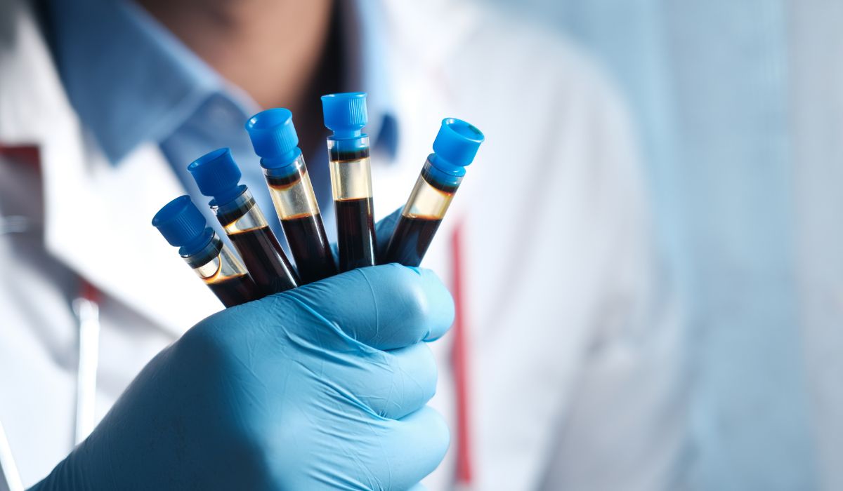 Does Phenyl 4 carboxylic show up on a drug test