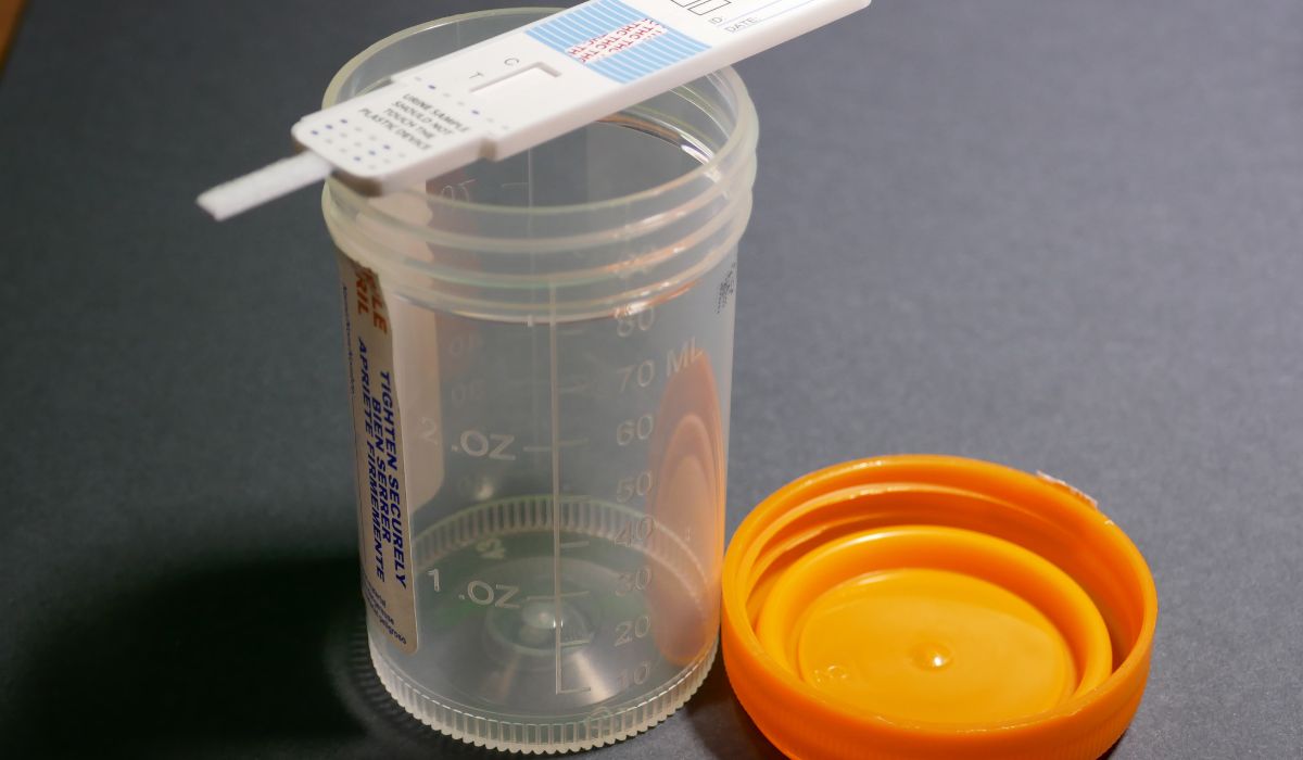 Meperidine Drug Test