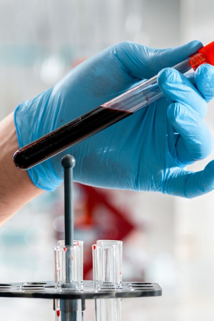 drug testing toxicology